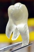 printedteeth1-143x214